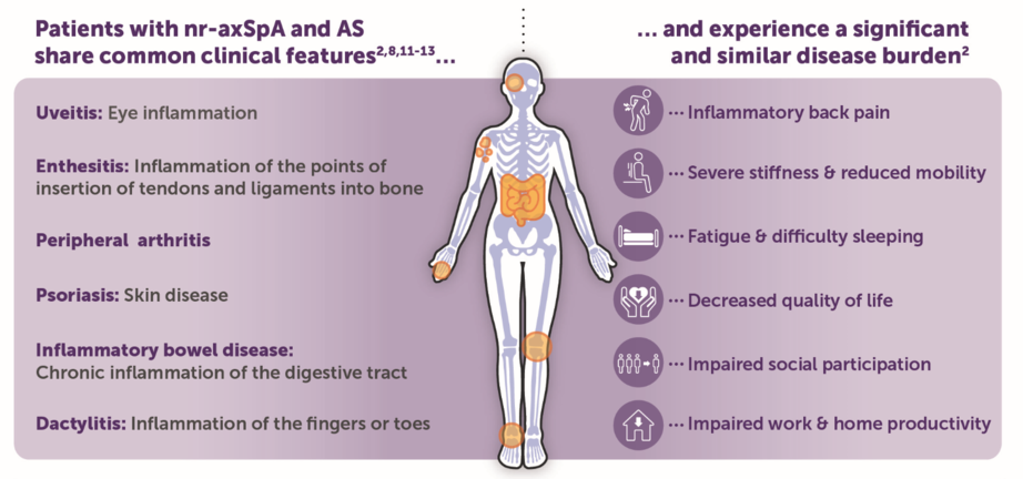  Axial Spondyloarthritis