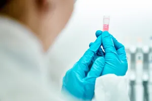 scientist holding antibodies
