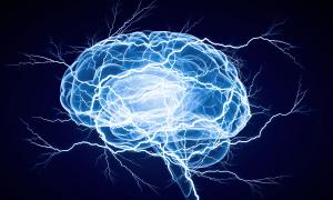 general picutre of neurology content
