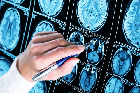 Picture of a doctor analyzing as scan