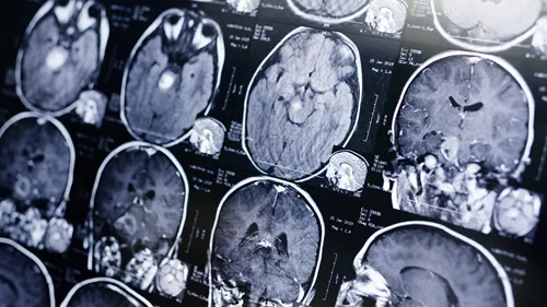 Picture of a scan