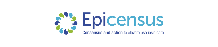 epicensus article logo 